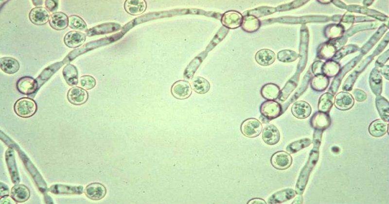 Candida Albicans, jamur yang menyebabkan oral thrush - youtube.com/biomedik8888